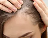 Dłonie kobiety dotykają linii włosów, gdzie widać drobne, odstające baby hair.