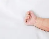 Rączka niemowlaka z czerwonymi plamkami, które przypominają kaszkę mannę.