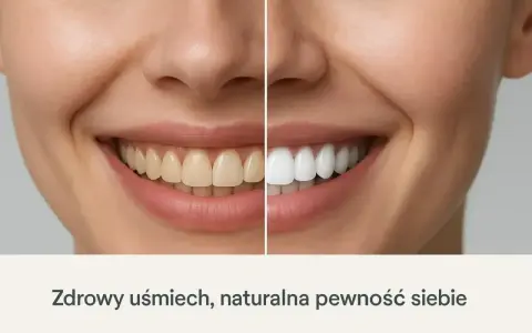 Porównanie uśmiechu: zęby przed i po wybieleniu. Zobacz, jak łatwo uzyskać olśniewającą biel i naturalną pewność siebie.