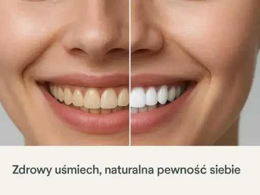 Porównanie uśmiechu: zęby przed i po wybieleniu. Zobacz, jak łatwo uzyskać olśniewającą biel i naturalną pewność siebie.