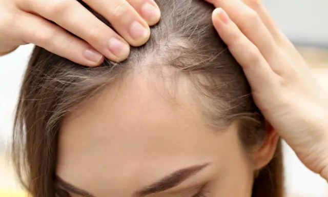 Dłonie kobiety dotykają linii włosów, gdzie widać drobne, odstające baby hair.