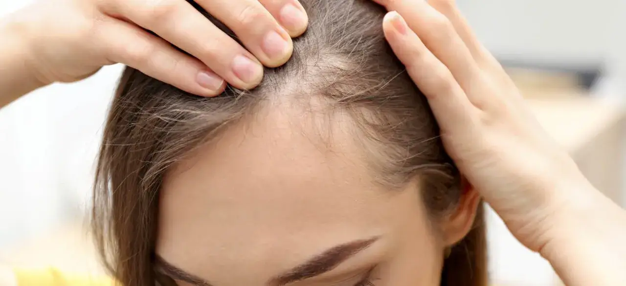 Dłoń dotyka czoła, uwidaczniając delikatne, odstające baby hair przy linii włosów.
